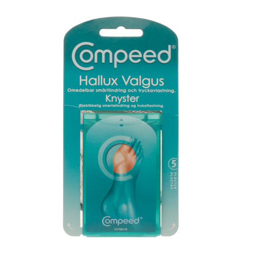 Hallux Valgus